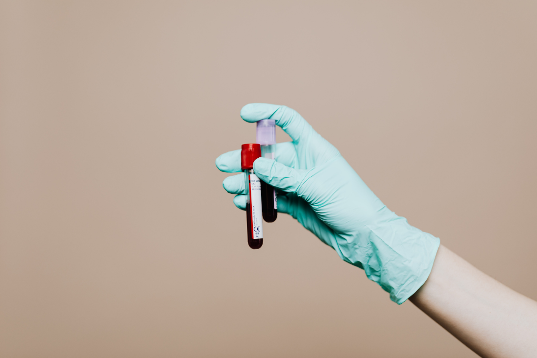 Mundotêxtil recebe colheita de sangue esta quinta-feira