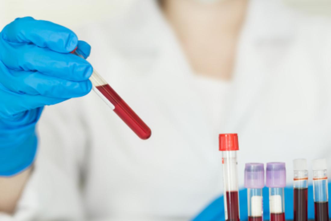 Centro Social de St. Eulália recebe hoje colheita de sangue 